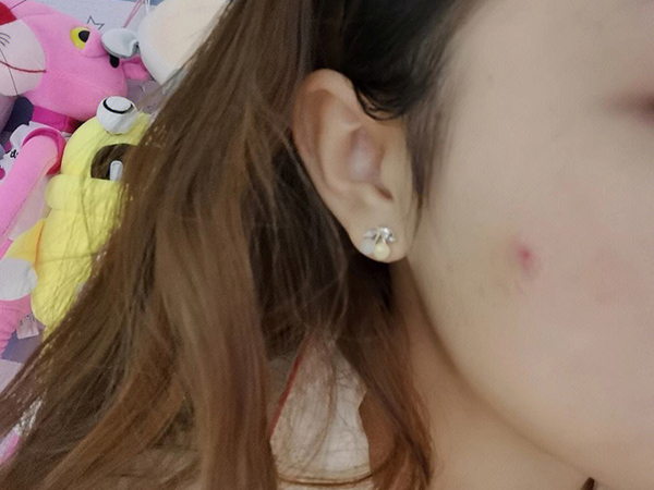 ������ӡ����