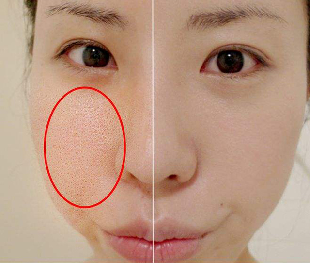 ë�״ִ���ô�죿�˶��ź�Ҳ������ë��