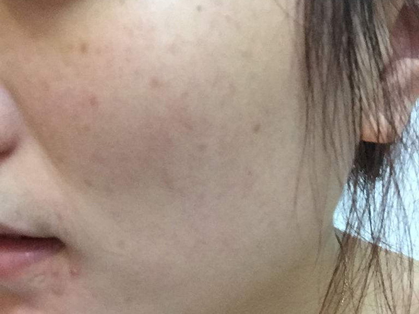 ������ɫ�ߺ��ѿ�������5����������