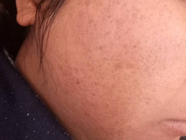 Ƥ��������Ƥ��ô�죿4�������������