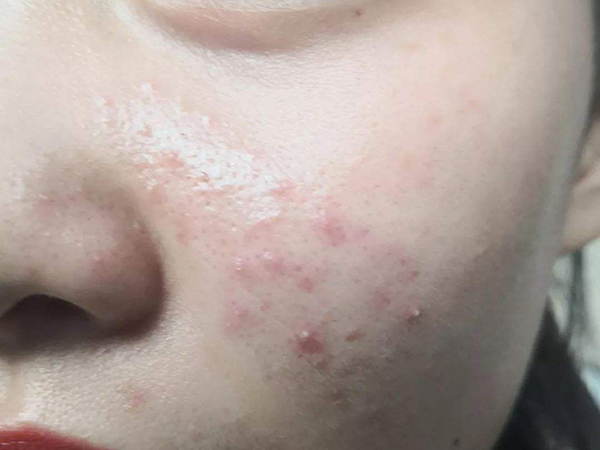 Ƥ������Ҳ�᳤��������4�п�Ӧ�ԣ�